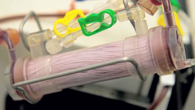 wyss-video-thumbnail-2-800